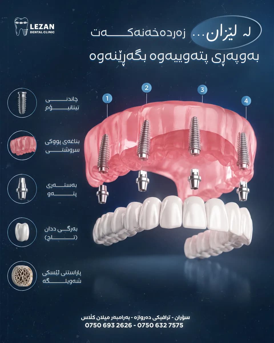 Lezan Dental social media post 10
