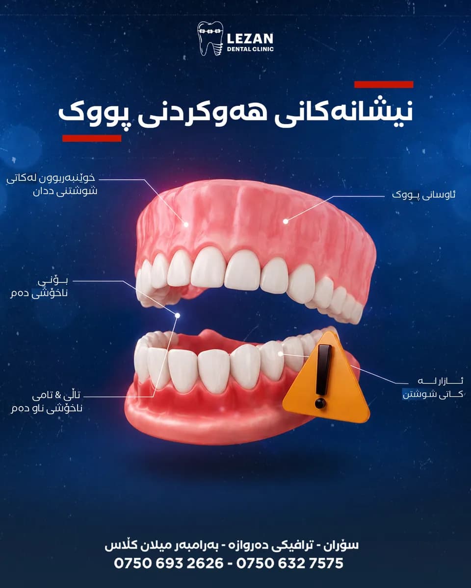 Lezan Dental social media post 6